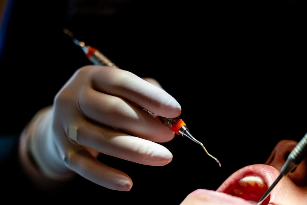 dentiste gisors soins gencives parodontologie Soins de gencives Cabinet du château - Dr Simon KOENIG