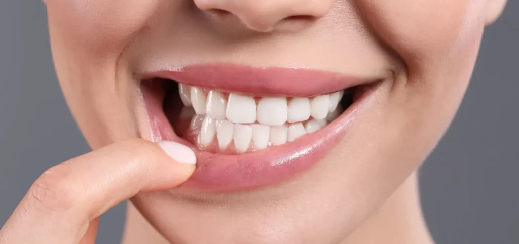 soins gencives detartrage Soins des gencives : nos conseils Cabinet du château - Dr Simon KOENIG