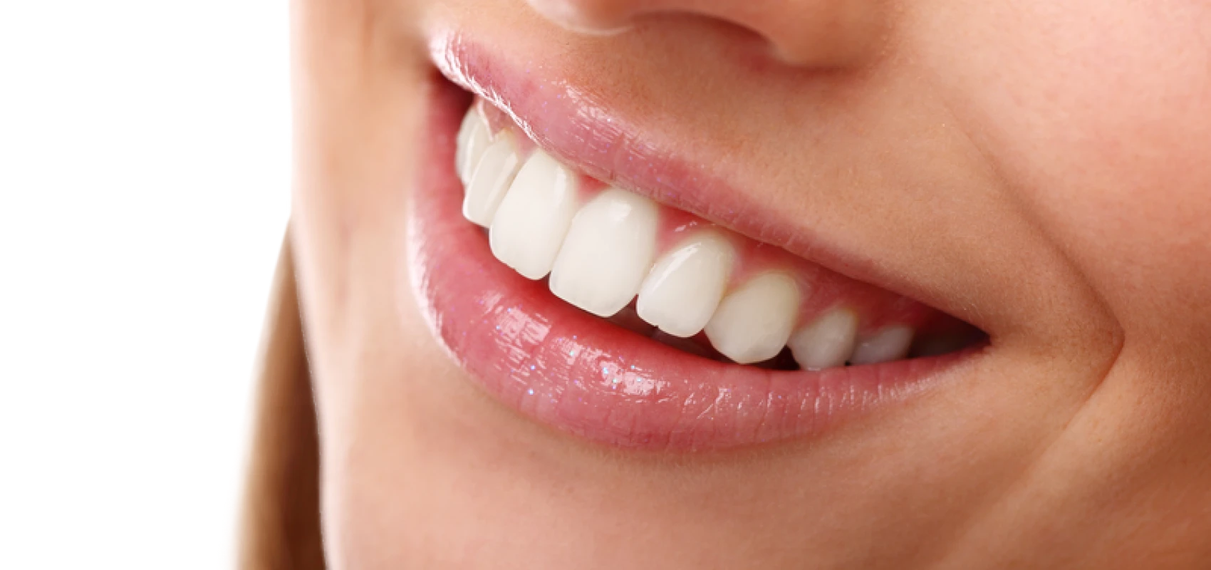 traitement esthetique dentaire Éclaircissement dentaire Cabinet du château - Dr Simon KOENIG